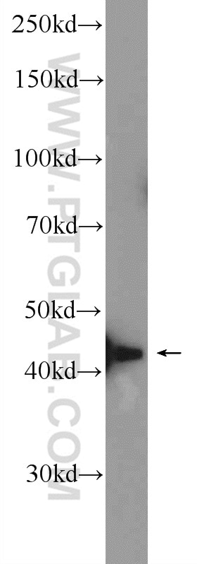 Western Blot (WB) analysis of mouse testis tissue using ZMYND12 Polyclonal antibody (25587-1-AP)