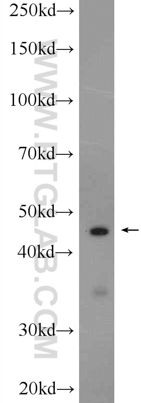 Western Blot (WB) analysis of rat testis tissue using ZMYND12 Polyclonal antibody (25587-1-AP)