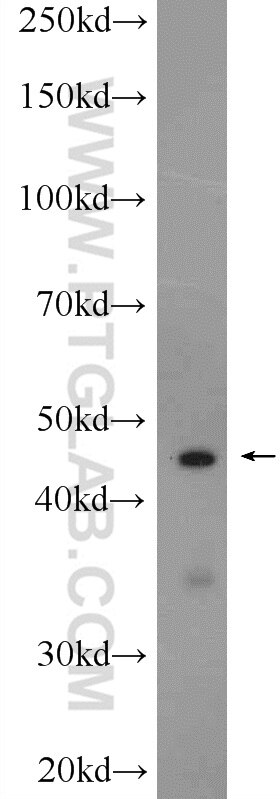 Western Blot (WB) analysis of rat testis tissue using ZMYND12 Polyclonal antibody (25587-1-AP)