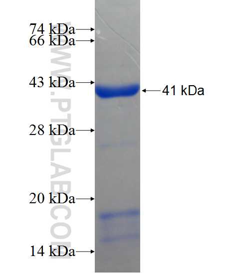ZMYND12 fusion protein Ag22358 SDS-PAGE