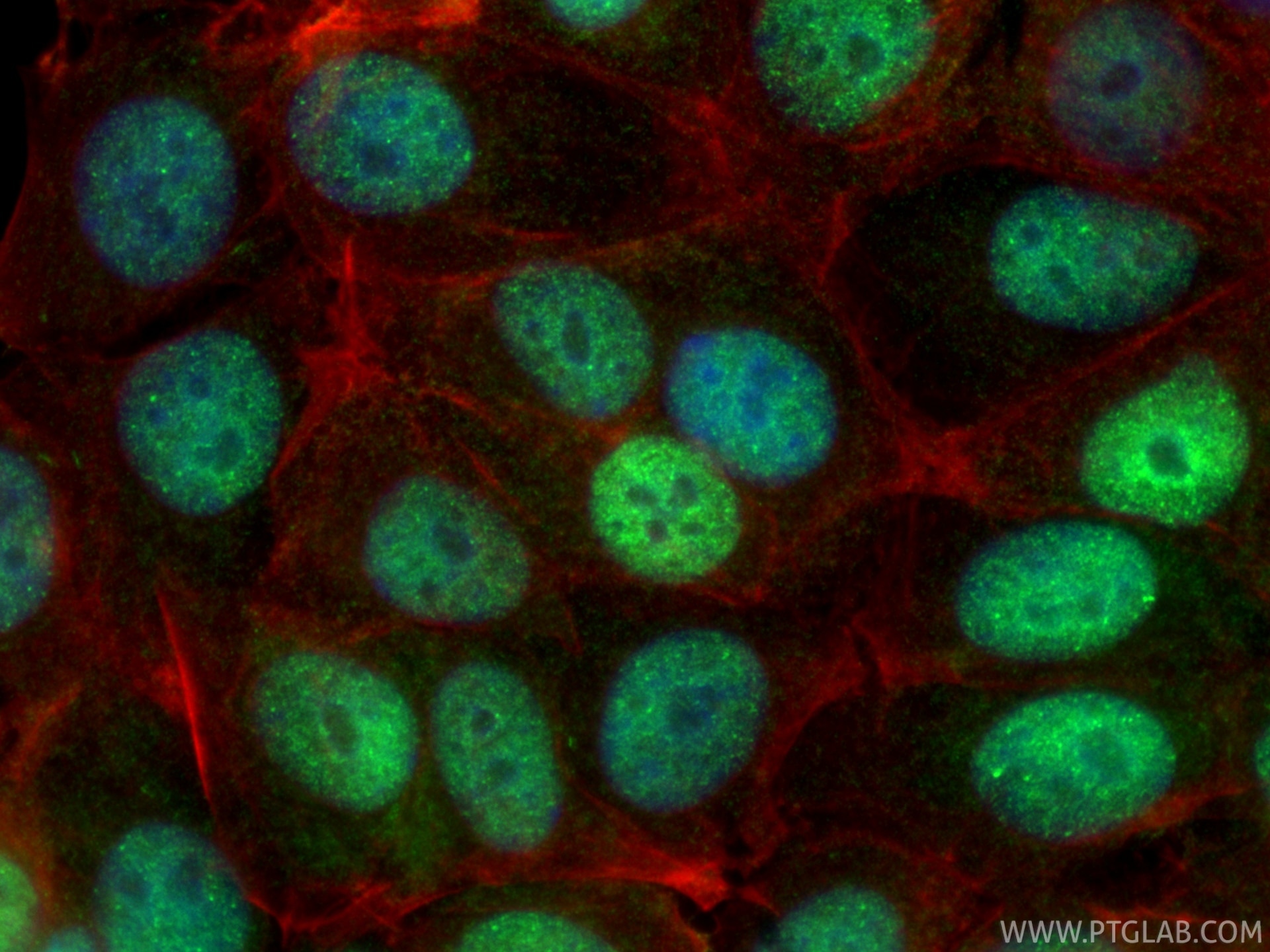 Immunofluorescence (IF) / fluorescent staining of MCF-7 cells using ZMYND8 Polyclonal antibody (11633-1-AP)