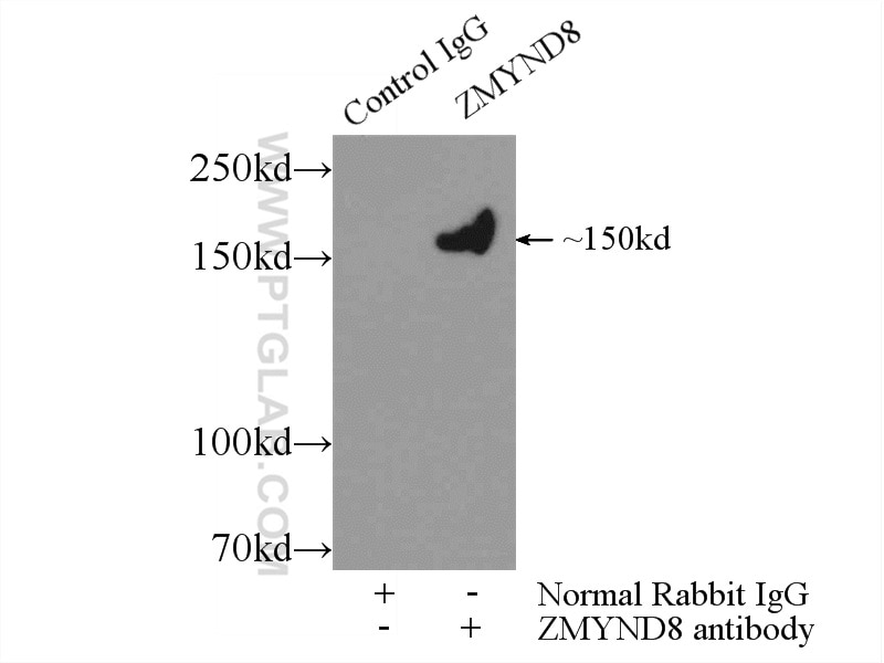 Immunoprecipitation (IP) experiment of HeLa cells using ZMYND8 Polyclonal antibody (11633-1-AP)