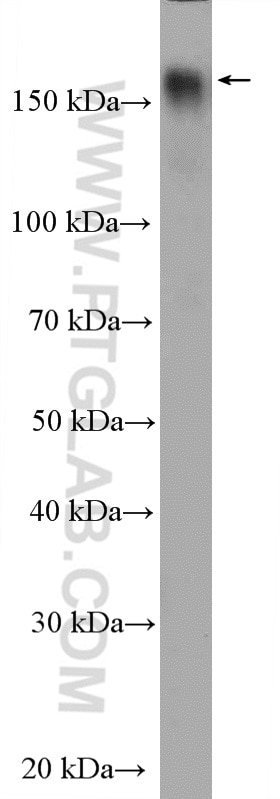 Western Blot (WB) analysis of HeLa cells using ZMYND8 Polyclonal antibody (11633-1-AP)