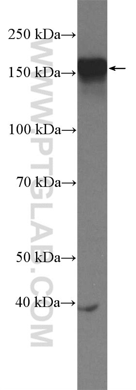 Western Blot (WB) analysis of MCF-7 cells using ZMYND8 Polyclonal antibody (11633-1-AP)