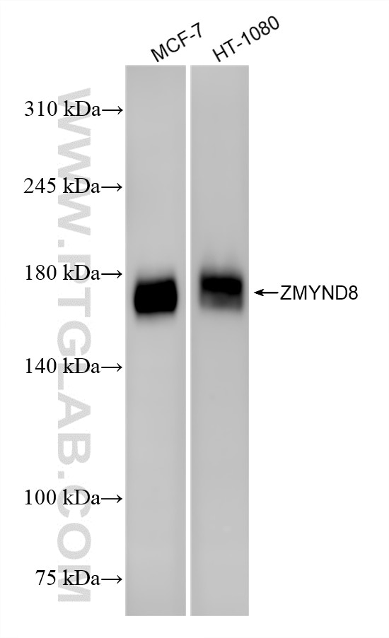 Western Blot (WB) analysis of various lysates using ZMYND8 Recombinant monoclonal antibody (86901-1-RR)