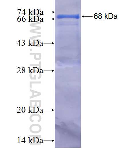 ZMYND8 fusion protein Ag2207 SDS-PAGE