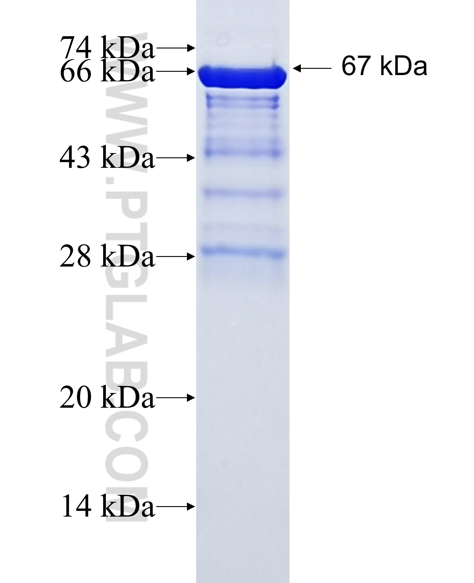 ZMYND8 fusion protein Ag2207 SDS-PAGE