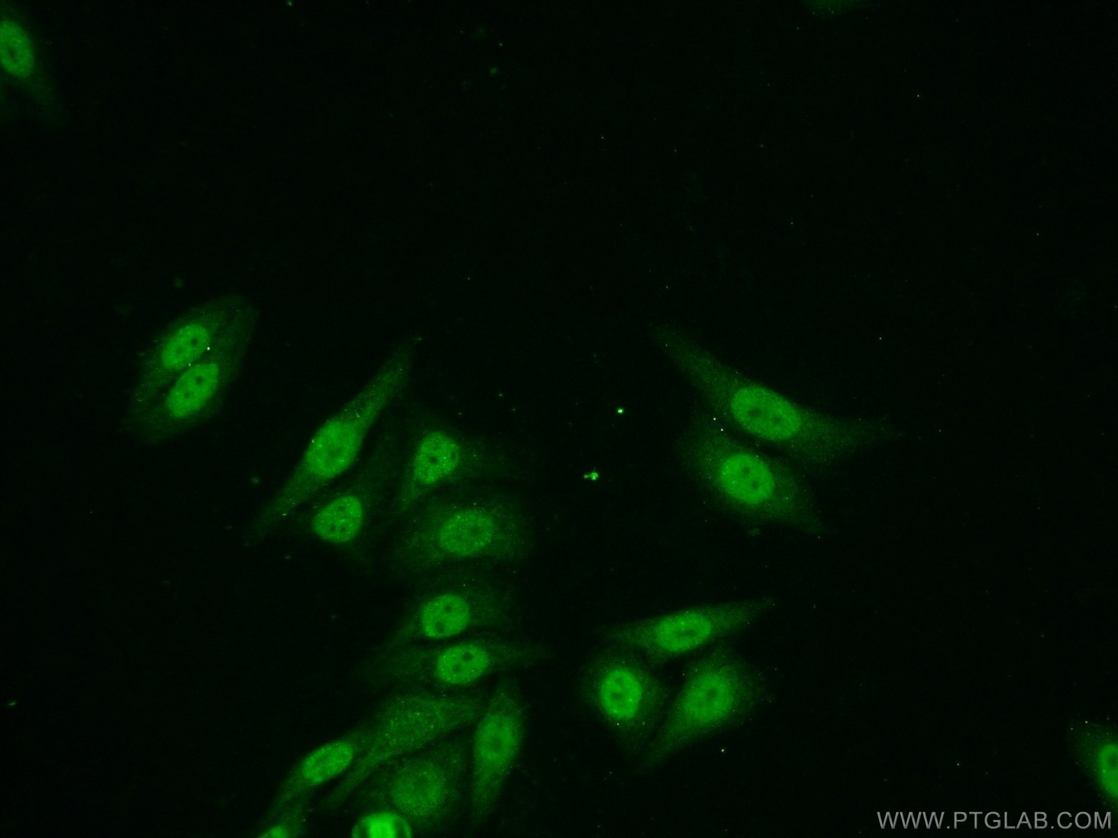 Immunofluorescence (IF) / fluorescent staining of HepG2 cells using ZNF101 Polyclonal antibody (25599-1-AP)