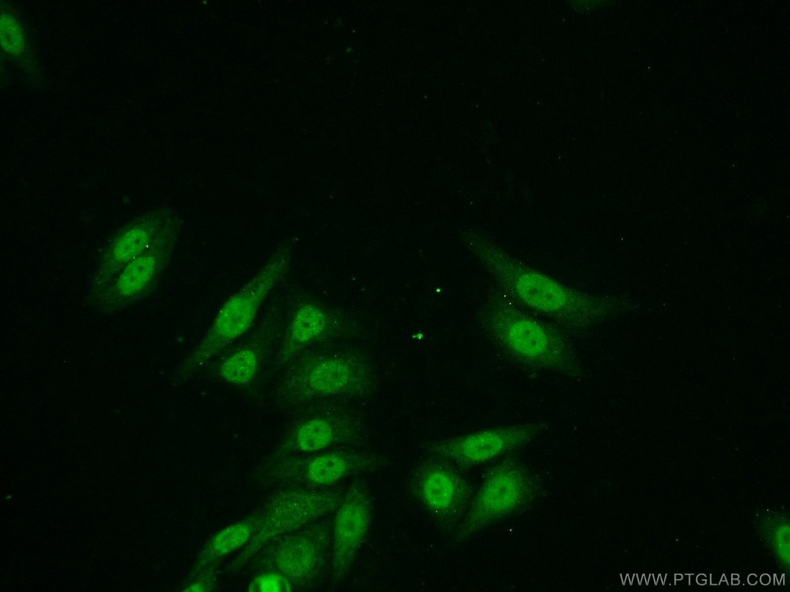 IF Staining of HepG2 using 25599-1-AP