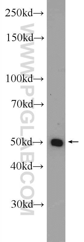 Western Blot (WB) analysis of HeLa cells using ZNF101 Polyclonal antibody (25599-1-AP)