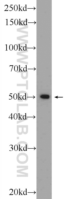 Western Blot (WB) analysis of HepG2 cells using ZNF101 Polyclonal antibody (25599-1-AP)