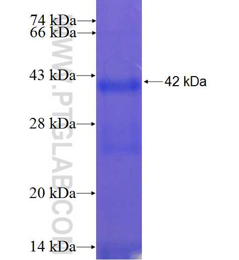 ZNF101 fusion protein Ag22390 SDS-PAGE