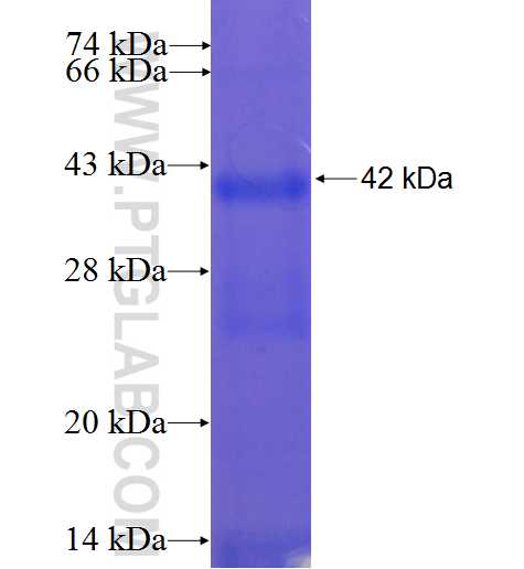 ZNF101 fusion protein Ag22390 SDS-PAGE