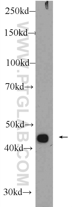 Western Blot (WB) analysis of COLO 320 cells using ZNF114 Polyclonal antibody (24974-1-AP)