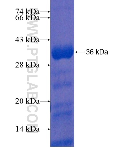ZNF114 fusion protein Ag21810 SDS-PAGE