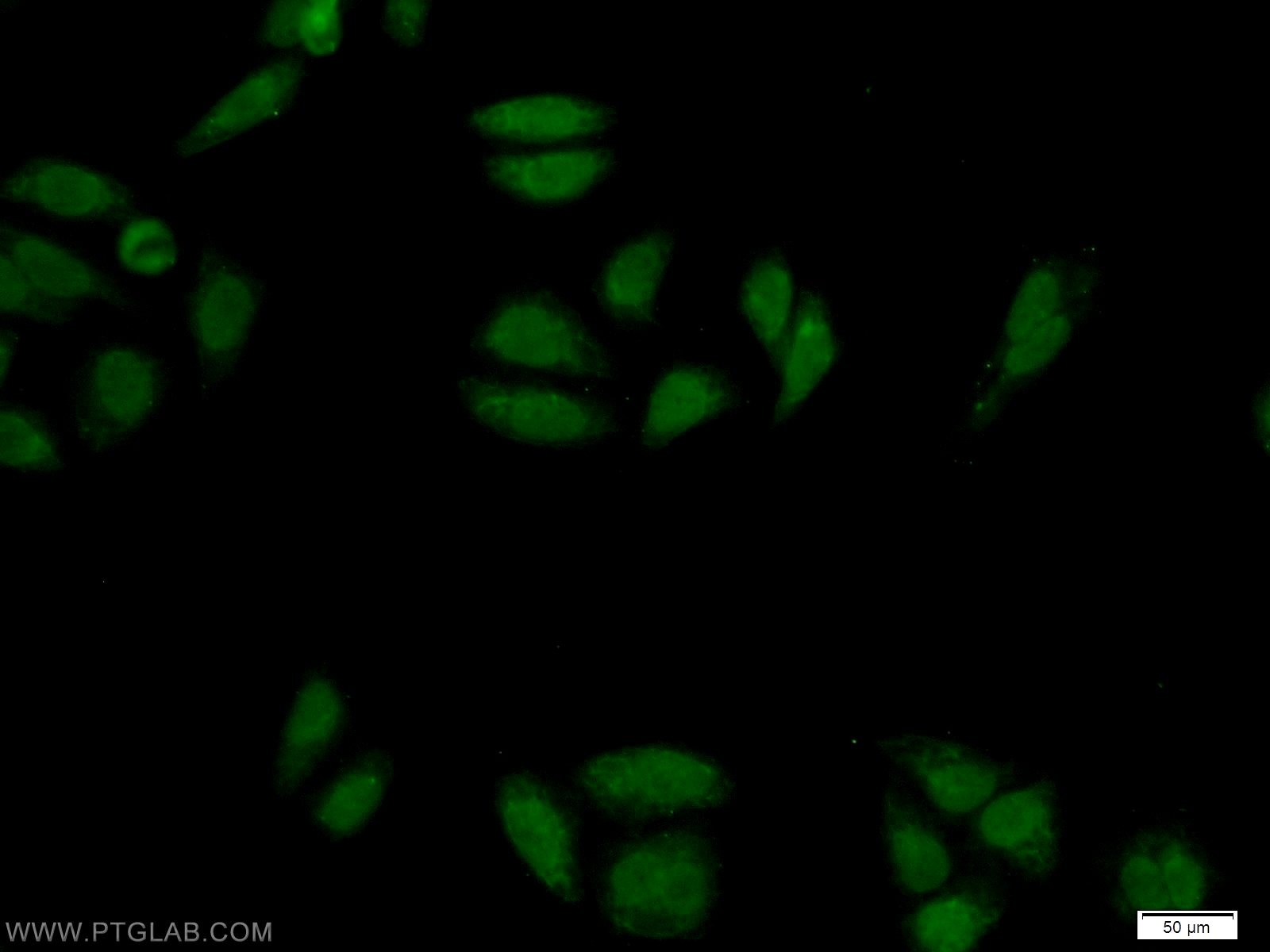 Immunofluorescence (IF) / fluorescent staining of HepG2 cells using ZNF124 Polyclonal antibody (25216-1-AP)