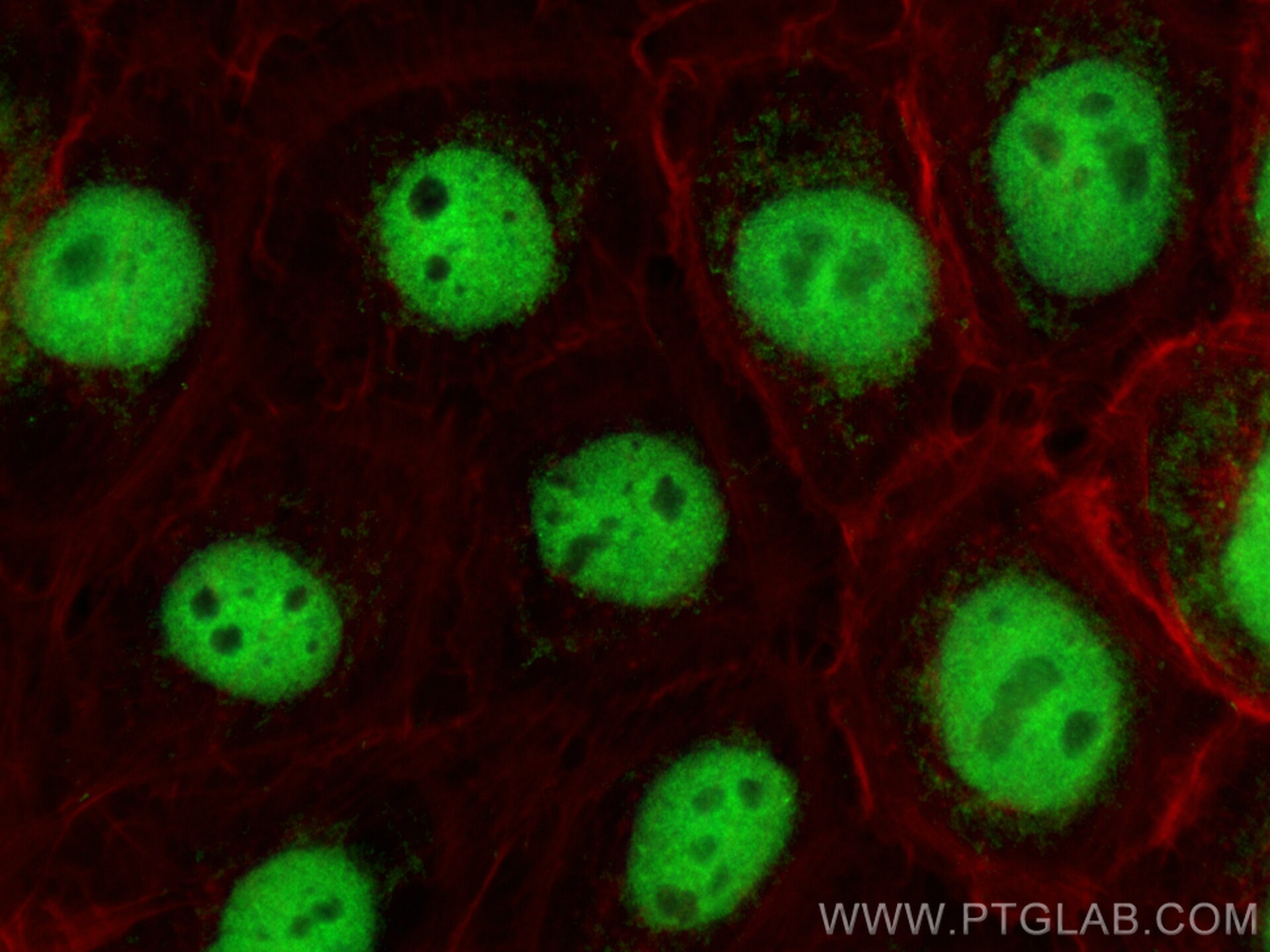 Immunofluorescence (IF) / fluorescent staining of A431 cells using ZNF124 Polyclonal antibody (25216-1-AP)