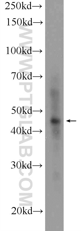 Western Blot (WB) analysis of U-937 cells using ZNF124 Polyclonal antibody (25216-1-AP)