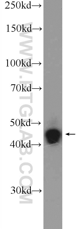 Western Blot (WB) analysis of SH-SY5Y cells using ZNF124 Polyclonal antibody (25216-1-AP)