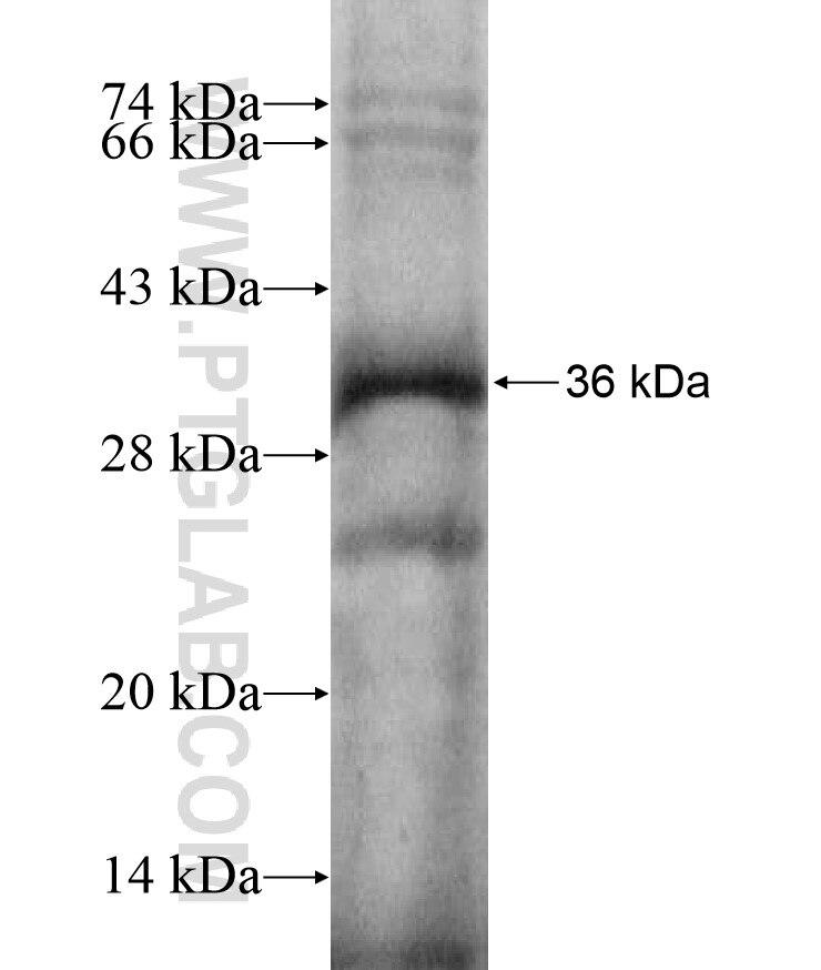 ZNF132 fusion protein Ag17373 SDS-PAGE