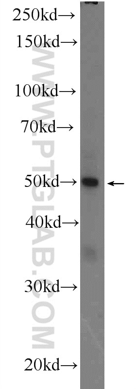 Western Blot (WB) analysis of MCF-7 cells using ZNF134 Polyclonal antibody (25515-1-AP)