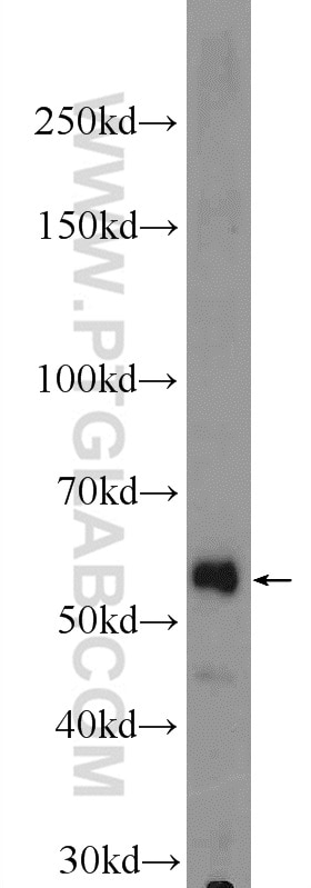 Western Blot (WB) analysis of human liver tissue using ZNF134 Polyclonal antibody (25515-1-AP)