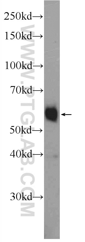 Western Blot (WB) analysis of human testis tissue using ZNF134 Polyclonal antibody (25515-1-AP)