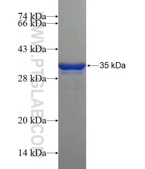 ZNF134 fusion protein Ag22290 SDS-PAGE