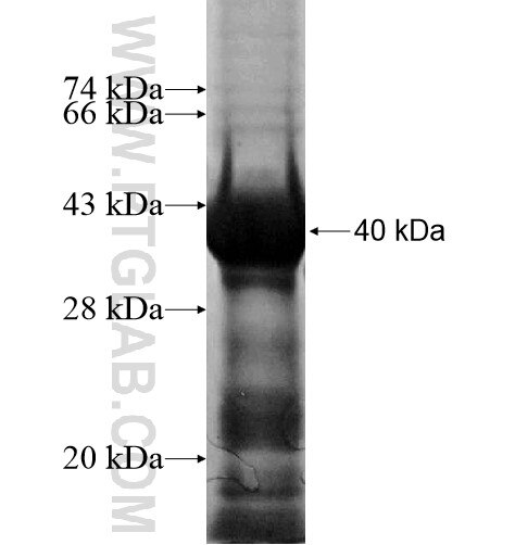 ZNF136 fusion protein Ag15423 SDS-PAGE