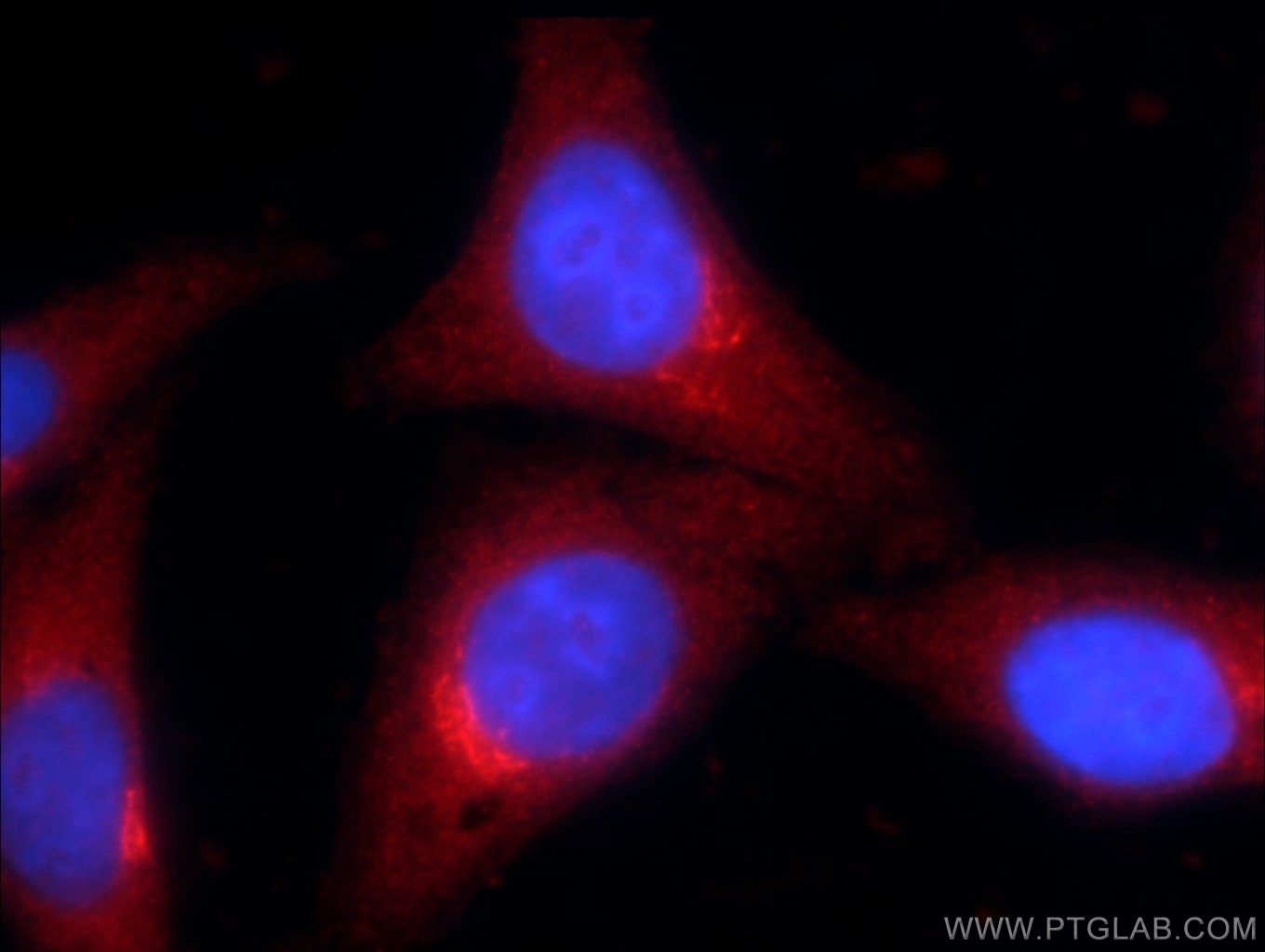 Immunofluorescence (IF) / fluorescent staining of HepG2 cells using ZNF140 Polyclonal antibody (24531-1-AP)