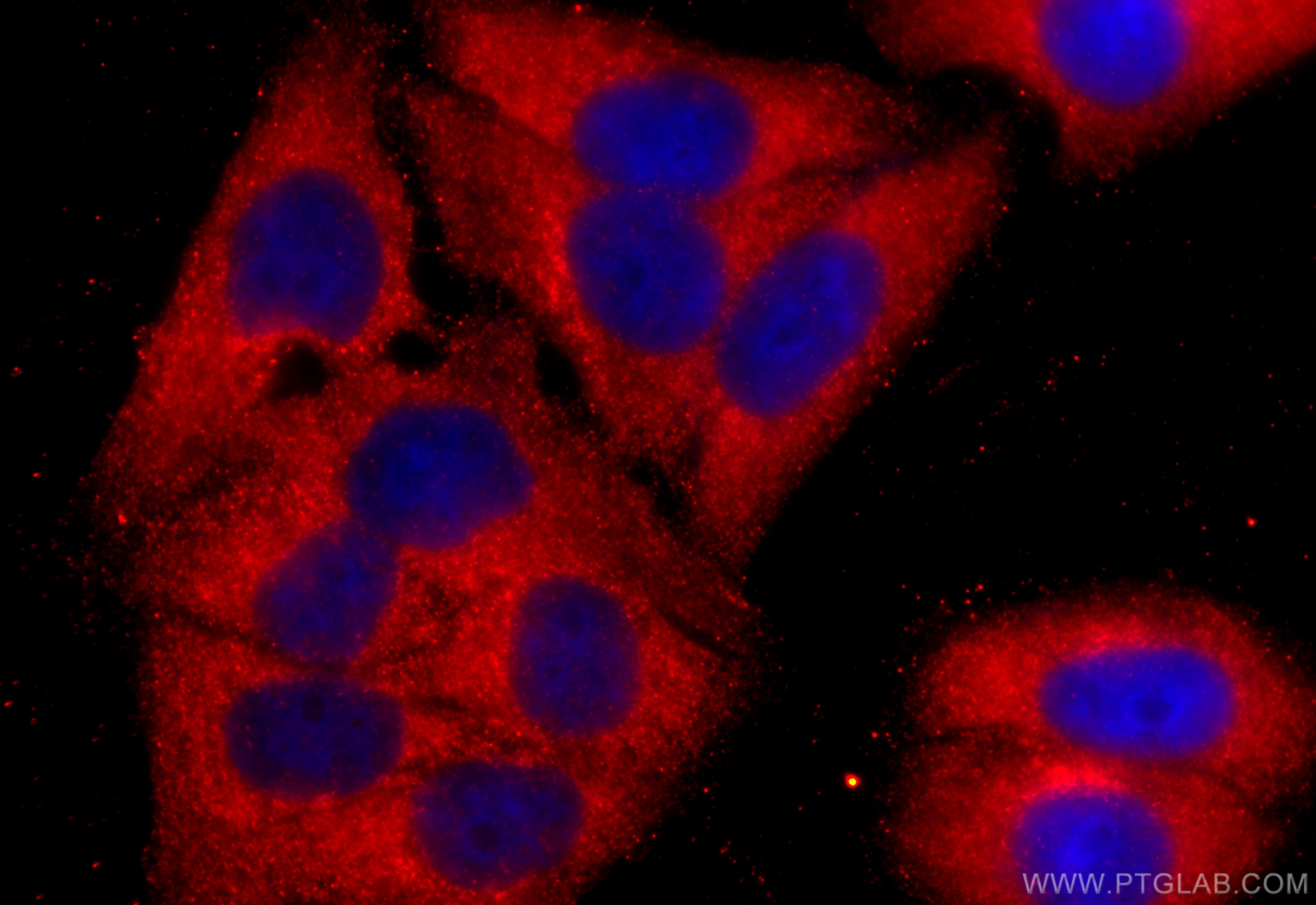 Immunofluorescence (IF) / fluorescent staining of HepG2 cells using ZNF140 Polyclonal antibody (24531-1-AP)