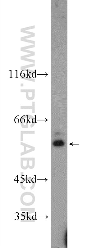 Western Blot (WB) analysis of Jurkat cells using ZNF140 Polyclonal antibody (24531-1-AP)