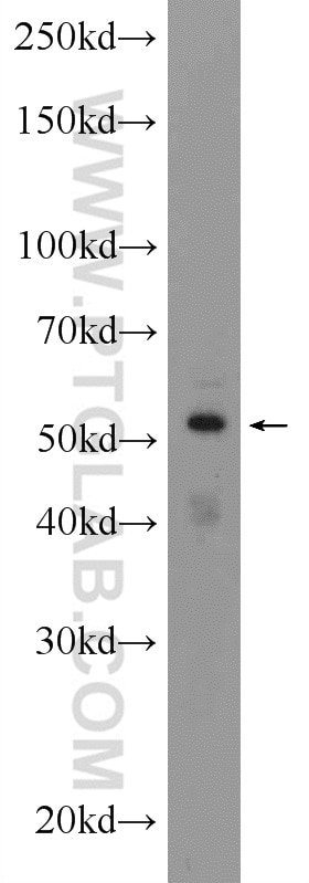 Western Blot (WB) analysis of SKOV-3 cells using ZNF140 Polyclonal antibody (24531-1-AP)