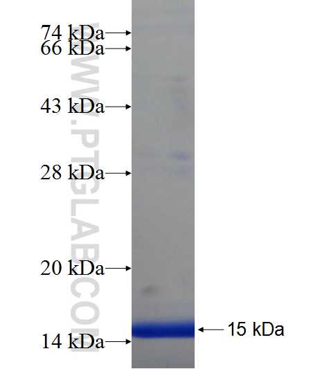 ZNF140 fusion protein Ag21379 SDS-PAGE