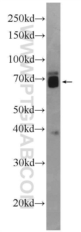Western Blot (WB) analysis of mouse brain tissue using ZNF143 Polyclonal antibody (16618-1-AP)