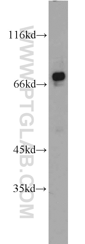 Western Blot (WB) analysis of mouse brain tissue using ZNF143 Polyclonal antibody (16618-1-AP)