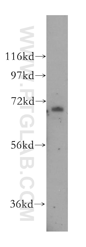 Western Blot (WB) analysis of HepG2 cells using ZNF143 Polyclonal antibody (16618-1-AP)