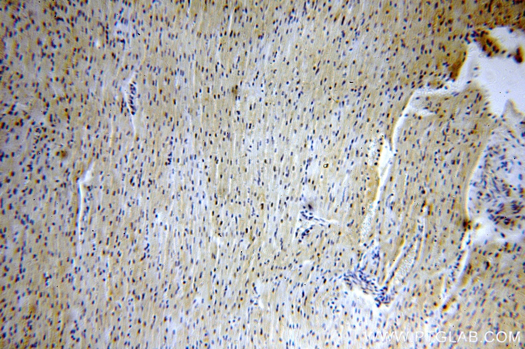 Immunohistochemistry (IHC) staining of human heart tissue using ZNF146 Polyclonal antibody (20385-1-AP)