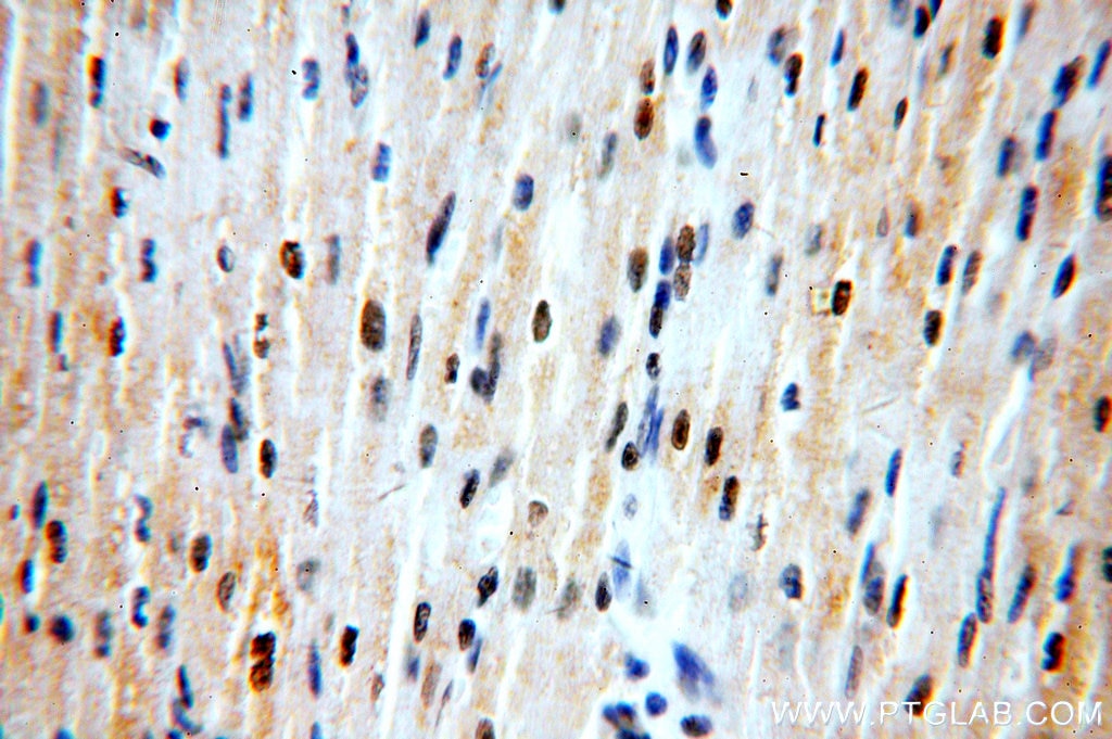 Immunohistochemistry (IHC) staining of human heart tissue using ZNF146 Polyclonal antibody (20385-1-AP)