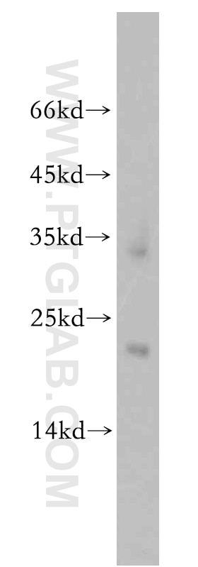 Western Blot (WB) analysis of mouse lung tissue using ZNF146 Polyclonal antibody (20385-1-AP)