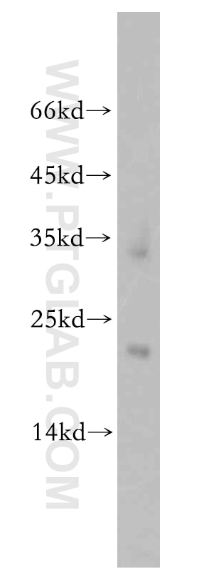 WB analysis of mouse lung using 20385-1-AP