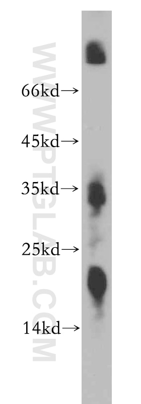 Western Blot (WB) analysis of mouse kidney tissue using ZNF146 Polyclonal antibody (20385-1-AP)