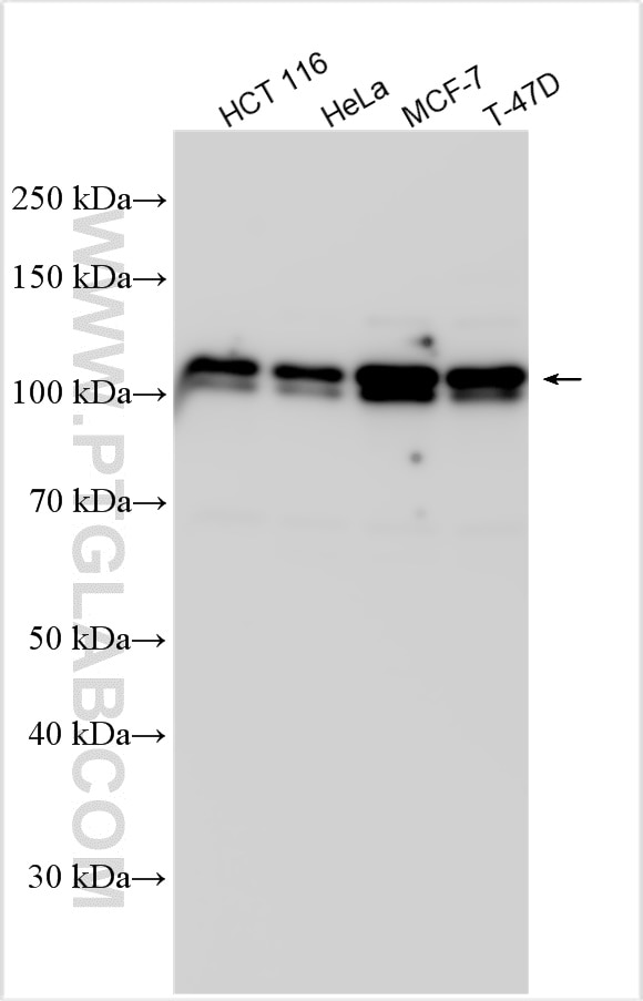 ZNF148