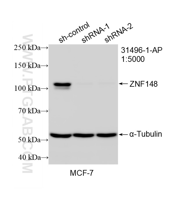 WB result of ZNF148 antibody (31496-1-AP; 1:5000; incubated at room temperature for 1.5 hours) with sh-Control and sh-ZNF148 transfected MCF-7 cells. Western Blot (WB) analysis of MCF-7 cells using ZNF148 Polyclonal antibody (31496-1-AP)