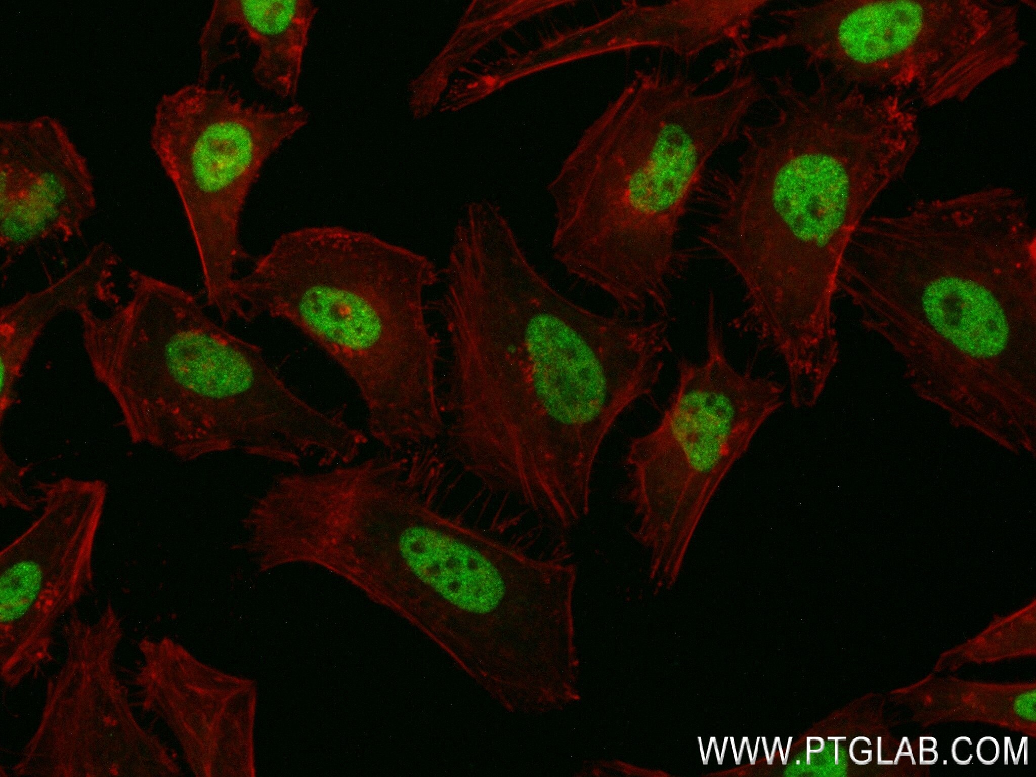 Immunofluorescence (IF) / fluorescent staining of HeLa cells using ZNF148 Recombinant antibody (84338-6-RR)