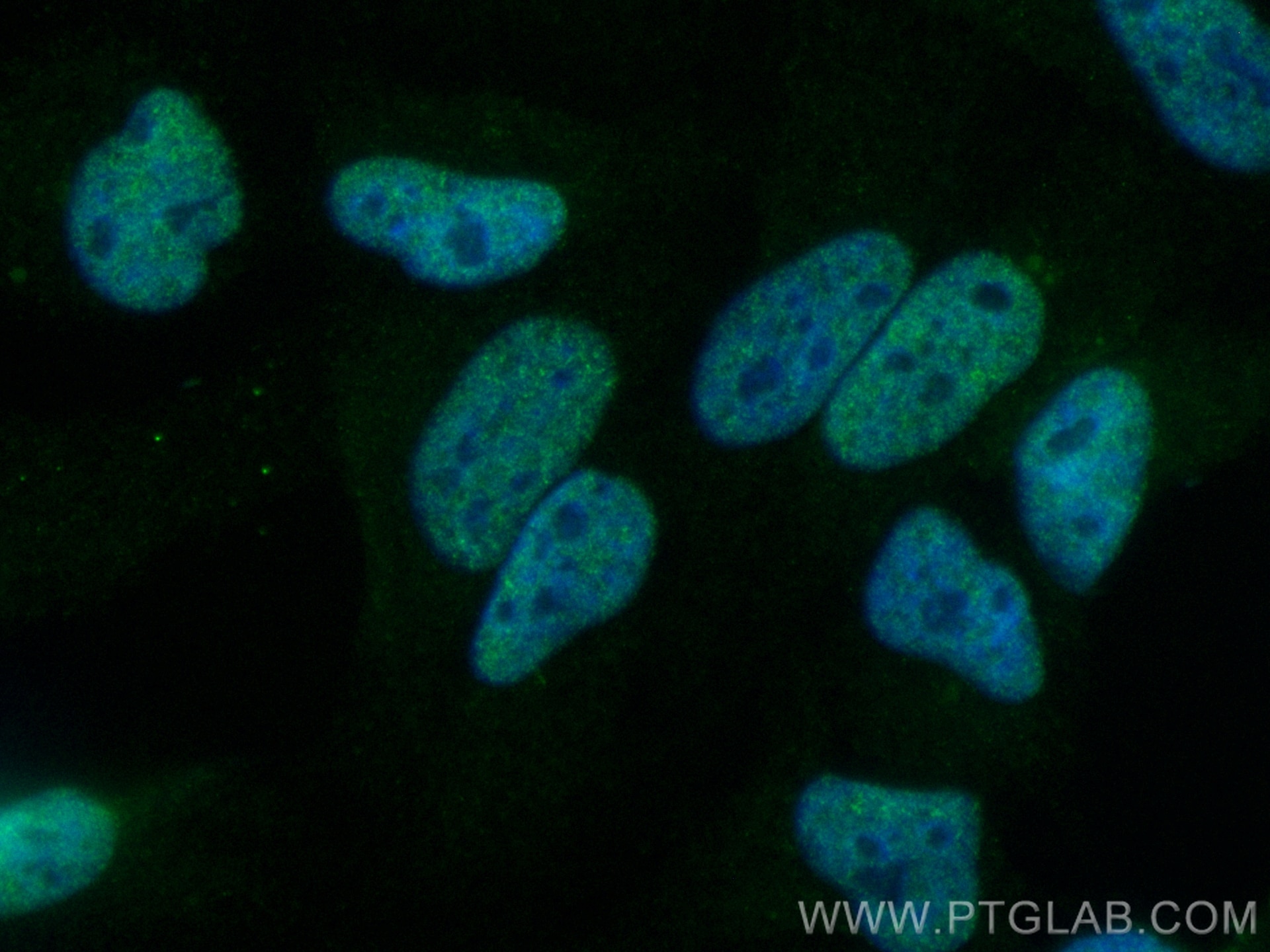 Immunofluorescence (IF) / fluorescent staining of HeLa cells using CoraLite® Plus 488-conjugated ZNF148 Recombinant a (CL488-84338-6)