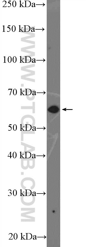 Western Blot (WB) analysis of HEK-293 cells using ZNF154 Polyclonal antibody (22161-1-AP)