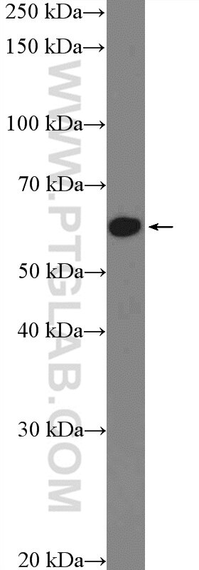 Western Blot (WB) analysis of MCF-7 cells using ZNF154 Polyclonal antibody (22161-1-AP)