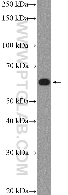 Western Blot (WB) analysis of A549 cells using ZNF154 Polyclonal antibody (22161-1-AP)