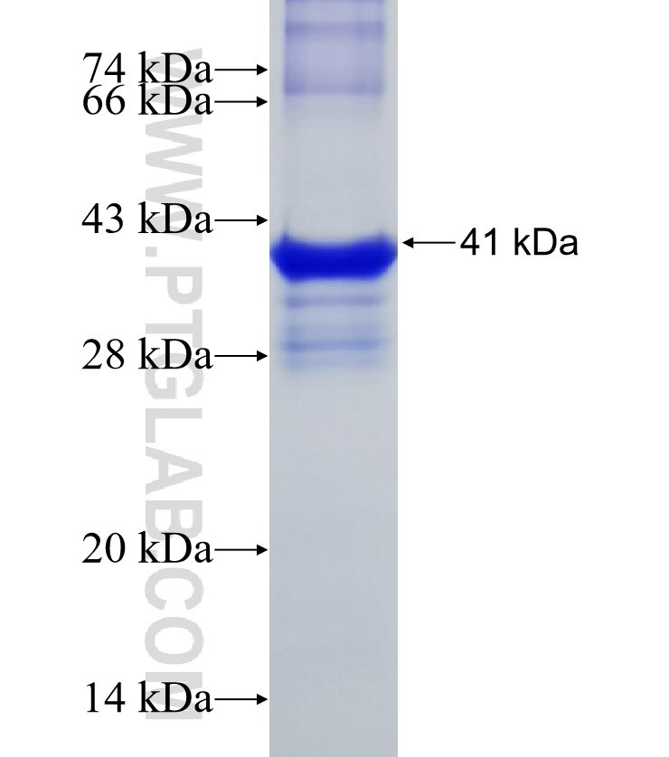 ZNF154 fusion protein Ag17812 SDS-PAGE